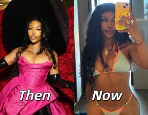 SZA Before Surgery: What Plastic Surgery Has She Had and Why Her Breast